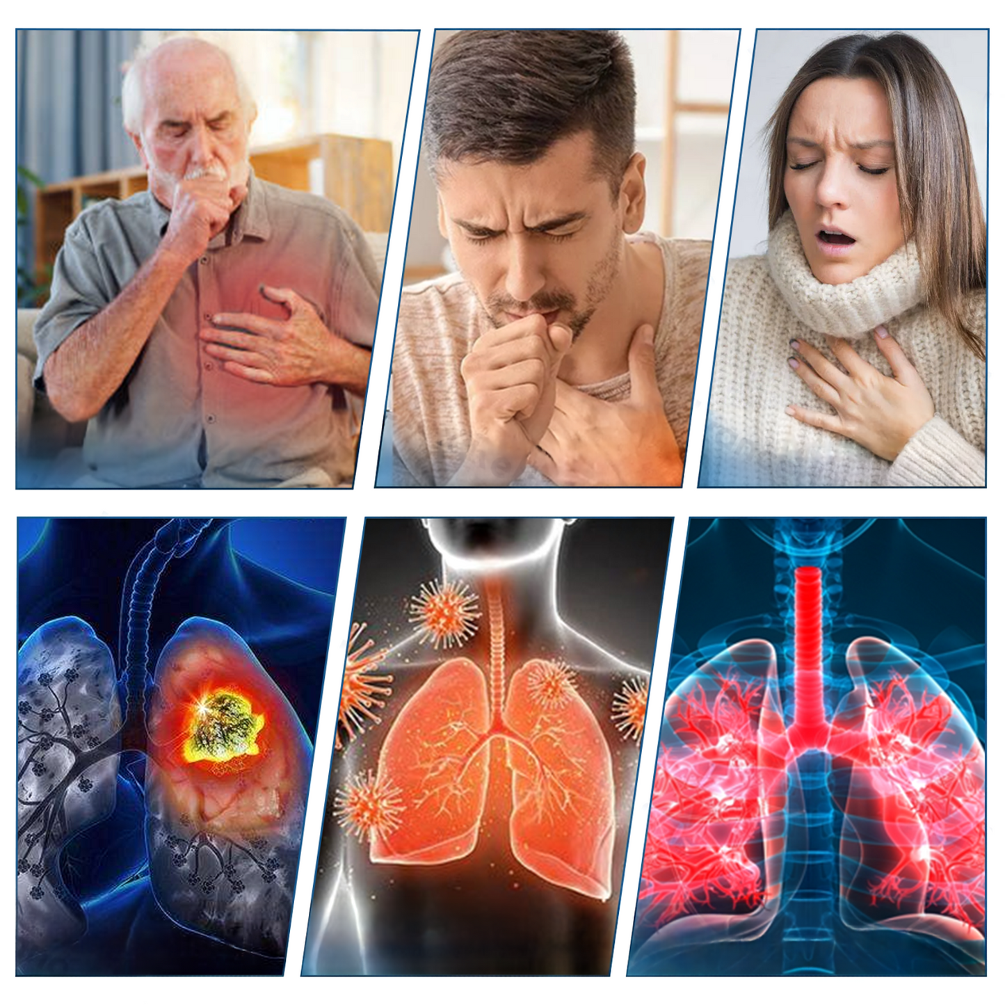 FDA Approved  DoubleNano COPD Relief Patch (💝 Cough, wheezing, shortness of breath, sputum, stuffy nose, bronchitis, bronchitis, allergy symptoms, lung discomfort)